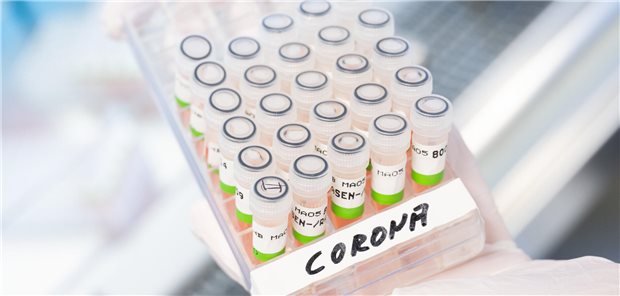 Immunologe Watzl: Bisher keine neue Corona-Variante, die besondere Wachsamkeit erfordert Tubes mit Corona-Beschriftung im Labor