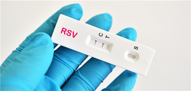 Positives RSV-Testergebnis unter Verwendung eines Antigen-Testkits für das Respiratorische Synzytial-Virus (RSV).