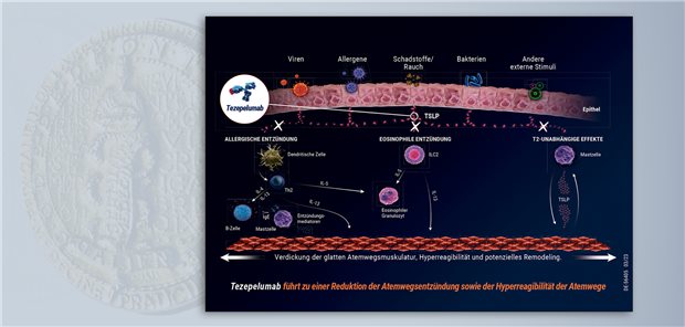 Der Antikörper Tezepelumab blockiert die Interaktion des epithelialen Zytokins TSLP mit seinem Rezeptor: Atemwegsentzündung sowie Hyperreagibilität der Atemwege bei schwerem Asthma bronchiale werden reduziert.