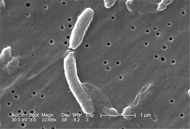 Cholera wird nur selten nach Deutschland importiert Der Cholera-Erreger Vibrio cholerae unter dem Elektronenmikroskop.