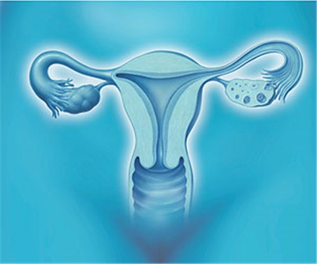 So wirkt die 'Pille danach' Der Eisprung kann mit der "Pille danach" verzögert werden.