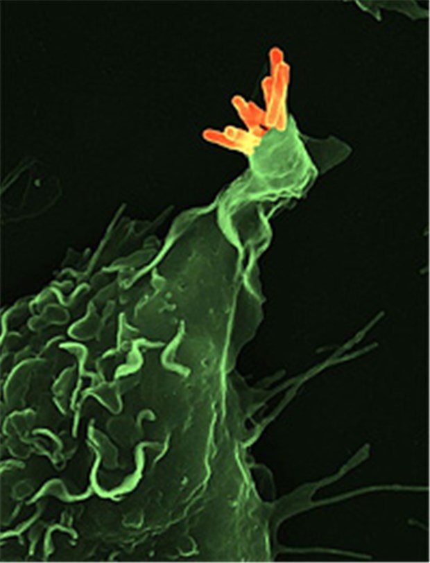 Tuberkulose bleibt in Deutschland ein Problem Der Erreger der Tuberkulose, das Bakterium Mycobakterium tuberculosis. © Max-Planck-Gesellschaft