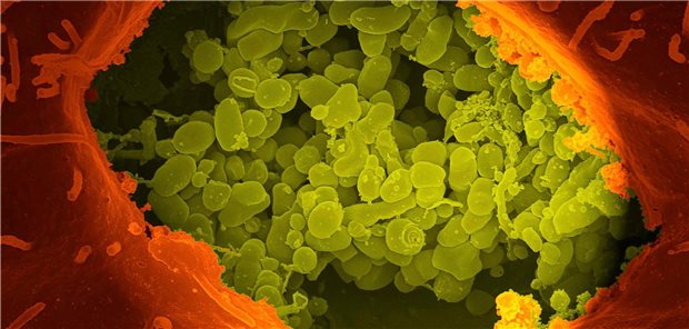 Der Erreger des Q-Fiebers, Coxiella burnetii, in einer kolorierten EM-Aufnahme.