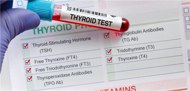 Blutprobenröhrchen für die Analyse von Schilddrüsentests mit Anforderungsformular für Schilddrüsentests im Hintergrund.