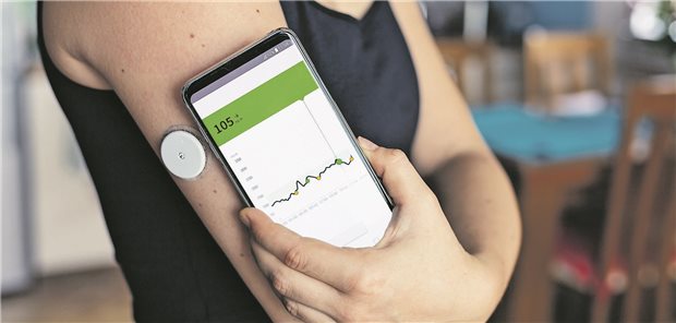 Glukosesensor