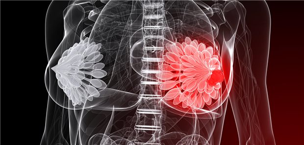 Der G-BA hat seine DMP-Anforderungen-Richtlinie umfassend aktualisiert.