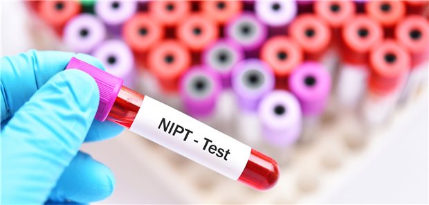 GBA: Gesetzgeber soll Position zu NIPT beziehen Blut-Probenröhren mit der Aufschrift "NIPT-Test" in einer Hand (im blauen Handschuh). Im Hintergrund sieht man eine Vielzahl solcher Proberöhrchen verschwommen.
