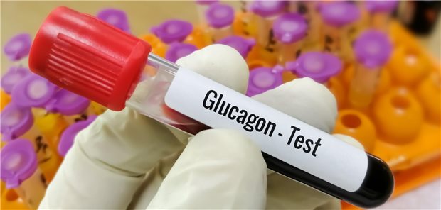  Glukagontest.