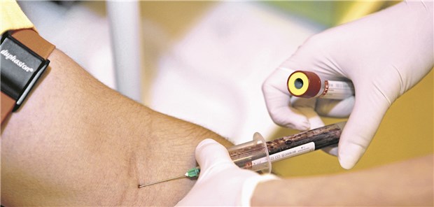 Gene schuld am hohen Harnsäurespiegel? Der Harnsäurespiegel im Blut könnte zu 25-60 Prozent von genetischen Faktoren abhängen.