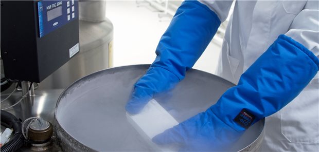 Wissenschaftler hadern mit gesetzlichen Beschränkungen der Stammzellforschung Der Import und die Verwendung von humanen embryonalen Stammzellen unterliegt in Deutschland vielen Beschränkungen.