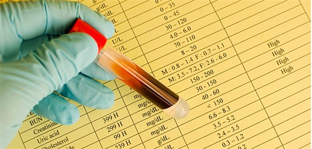 Der LDL-Zielwert richtet sich nach dem Risiko für eine tödliche kardiovaskuläre Erkrankung.