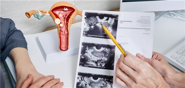 Der MD Bund kritisiert, dass Ultraschalluntersuchungen der Eierstöcke bei jüngeren Frauen schaden kann.