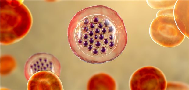 Hunderttausende zusätzliche Malaria-Tote wegen COVID-19-Pandemie Der Malaria-Erreger Plasmodium falciparum im Schizont-Stadium in Erythrozyten.