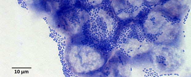Steckbrief eines nicht alltäglichen Erregers Der Maurer: O104:H4 bildet an der Darmmukosa eine "Mauer aus Backsteinen". Diese Fähigkeit hat er von enteroaggregativen E. coli (EAEC) erworben.