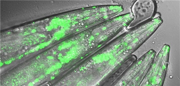 Der Modellorganismus C. elegans mit mutiertem Huntington Gen unter dem Mikroskop. Das Ausschalten des Schutz-Proteins UBR5 führte zu einem drastischen Anstieg des toxischen „Huntingtin“-Proteins in den Neuronen. Diese Anhäufungen sind auf dem Bild in grün zu erkennen.