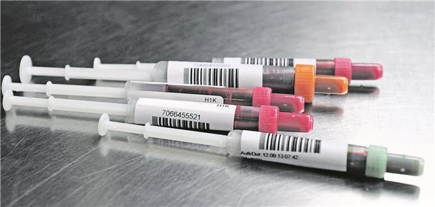 Antikörpernachweis könnte zweite Corona-Impfung ersetzen Der Nachweis von Antikörpern gegen SARS-CoV-2 erfolgt in der Regel über das Blut.