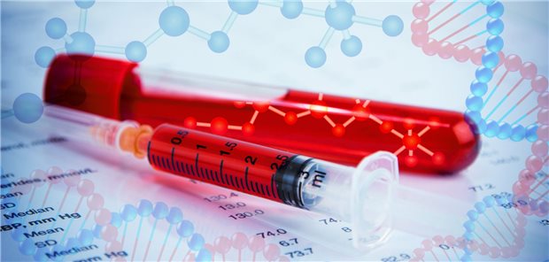 Der Nachweis von zirkulierender Tumor-DNA in der Liquid Biopsy scheint beim CRC zur Therapiesteuerung nutzbar zu sein.