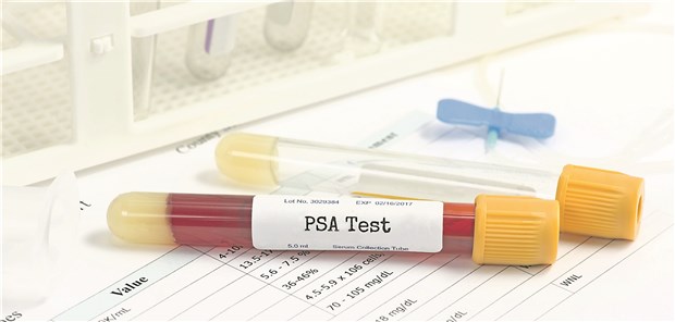 Der PSA-Test ist weder besonders sensitiv noch sonderlich spezifisch.