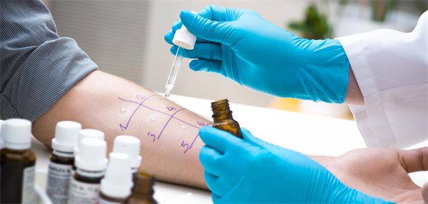 Eine Ärztin tropft Allergielösung auf den präparierten Unterarm einer Patientin für den Pricktest.