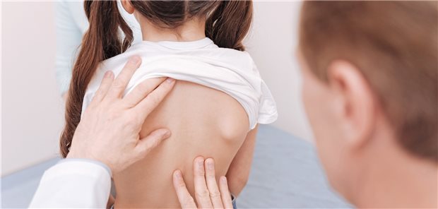 Der Rücken tut weh – gibt es einen auffälligen Befund?