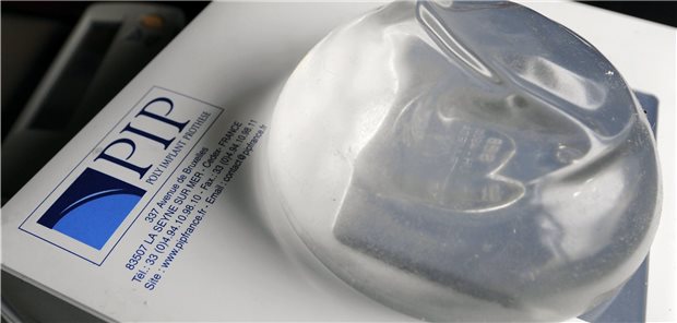 Gericht verurteilt TÜV zu Schadenersatz in Brustimplantate-Skandal Der Skandal um minderwertige Brustimplantate des inzwischen insolventen Anbieters hat weite Kreise gezogen und war sogar Mitauslöser der Novellierung der EU-Medizinprodukteverordnung.