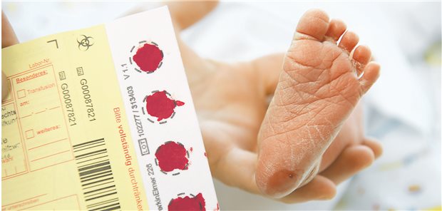 Der Test auf Mukoviszidose ist seit 2016 fester Bestandteil des Neugeborenen-Screenings.