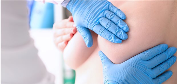 Der Traum von einer „Wohlfühl-Brust“: Entscheidend für eine Kostenübernahme einer Mammaaufbauplastik (MAP) ist laut BSG-Urteil die „objektive Auffälligkeit“. (Symbolbild mit Fotomodell)