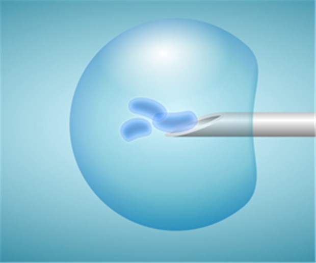 Geklont: Embryo mit dreifachem Chromosomensatz Der Trick beim Klonen: Eine Eizelle wird entkernt und dann mit einem fremden Zellkern bestückt.