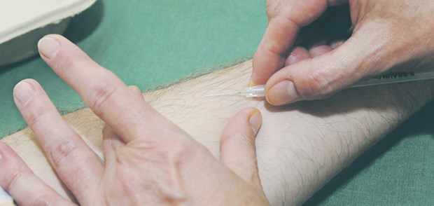Tuberkulin-Hauttest wird bei Erwachsenen gestrichen Der Tuberkulin-Test war Jahrzehnte Screening-Standard.