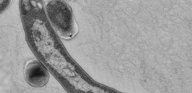Wo bleiben die Fortschritte? Der Tuberkulose-Erreger Mycobacterium tuberculosis, aufgenommen unter dem Elektronenmikroskop.
