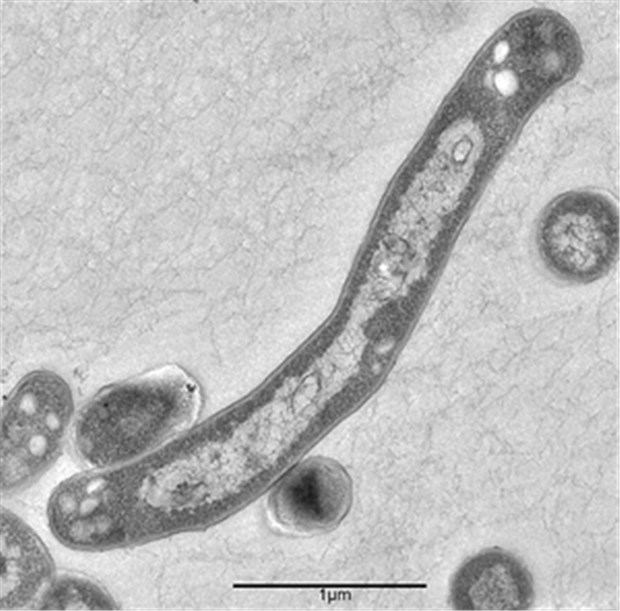 Tuberkulose bei Kindern auf dem Vormarsch Der Tuberkulose-Erreger Mycobacterium tuberculosis unter dem Elektronenmikroskop.