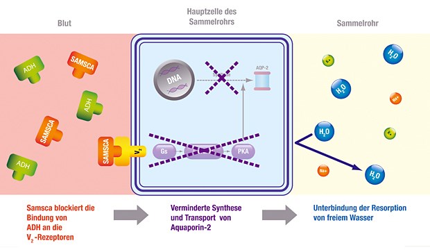 Der Vasopressin-V2-Rezeptor-Antagonist Tolvaptan (Samsca®) hemmt selektiv die über das Anti-Diuretische Hormon (ADH) gesteuerte Rückresorption von Wasser aus dem Sammelrohr der Niere.