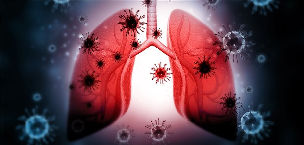Der anteilige Nachweis respiratorischer Viren bei wegen akuter Exazerbation stationär behandelten COPD-Patienten hatte in einer Studie erheblich abgenommen.