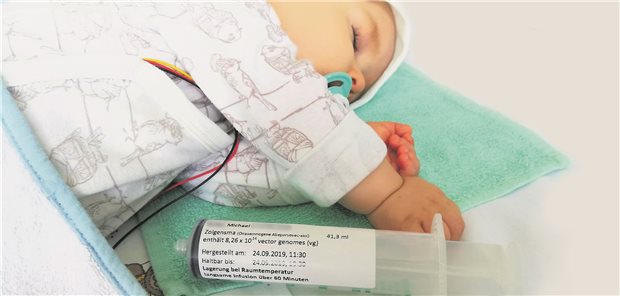 Der einjährige Michael schläft, während er eine Injektion mit dem Genpräparat Zolgensma gegen spinale Muskelatrophie bekommt.