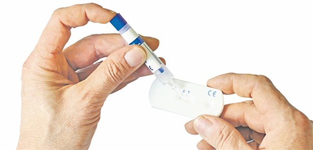 Der immunolgische Stuhltest als Kassenleistung ist gefragt.