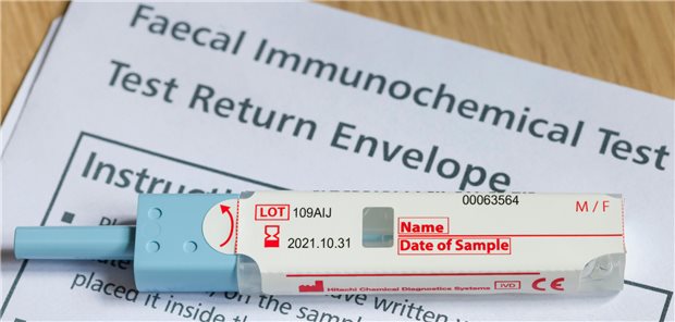 Der immunologische Test auf okkultes Blut im Stuhl (iFOBT, englisch: FIT) ist eine zuverlässige Früherkennungsmethode für Darmkrebs. (Symbolbild)
