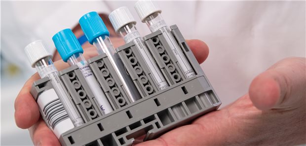 Der serologische Antikörpertest Elecsys Anti-SARS-CoV-2 von Roche ist neu auf den Markt gekommen.