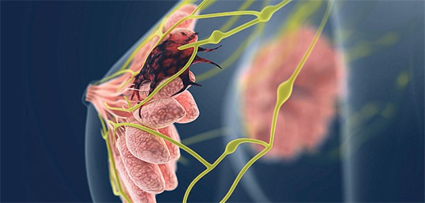 IQWiG folgt nicht Leitlinien-Empfehlung Der uPA/PAI-1- Test soll die Therapieentscheidung für oder gegen adjuvante Chemotherapie bei nodal negativem Mammakarzinom stützen.