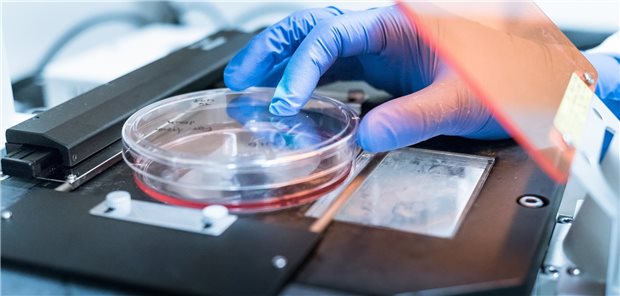Pathologe kommt nach fatalen Fehlbefunden glimpflich davon Der verurteilte Pathologe leitete seit 2008 ein Labor. Wegen seiner Alkohol- und Drogensucht kam es dort zu falschen Befunden.