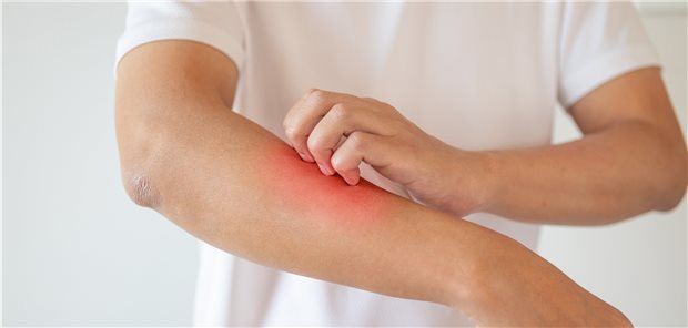 Dermatitis in Zeiten von COVID-19 war ein Thema von vielen bei der Tagung der Deutschen Dermatologischen Gesellschaft.