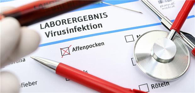 Dermatologen rechnen nicht zuletzt im Zuge der kontinuierlichen Erderwärmung mit einer steigenden Zahl an Patienten mit Affenpocken in Deutschland.
