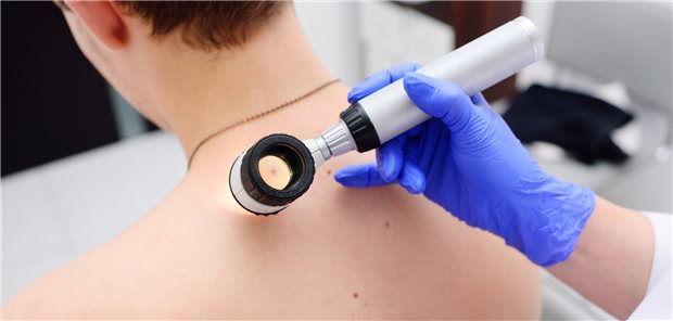 Dermatologische Kontrolle: Invasive Melanome sind nicht selten kleiner als 6 mm, warnen Dermatologen.