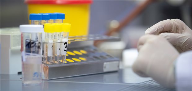 Pool-Testung auf SARS-CoV-2 könnte Testkapazität weltweit deutlich steigern Derzeit werden nach Angaben des Uniklinikums Frankfurt in Deutschland etwa 40.000 Tests auf SARS-CoV-2 pro Tag durchgeführt.