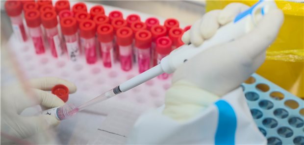 Derzeit werden weniger PCR-Tests als Antigen-Schnelltests eingesetzt, wenn es darum geht, Corona-Infektionen zu erkennen. Für den BDL ist das ein unzureichendes Monitoring.