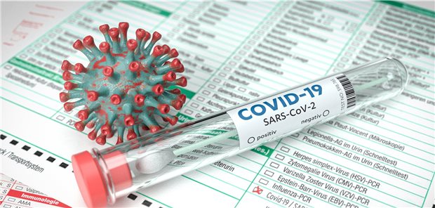 Deutschlands Gesundheitssystem hat sich nach Expertenmeinung in der Coronakrise bewährt. Erfolgreich war vor allem die Strategie, COVID-19 Tests nicht in Kliniken durchzuführen.