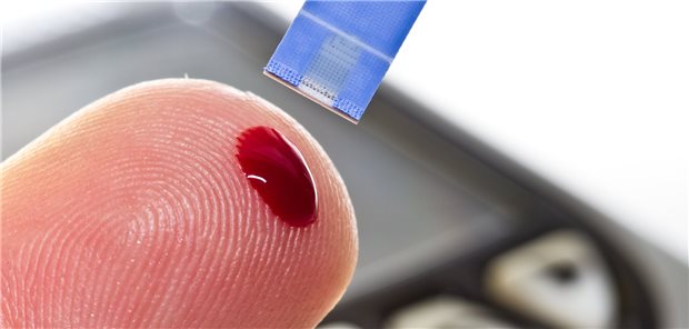 Oberhausen hält traurigen Diabetes-Rekord Diabetes-Check: 8,2 %aller Menschen zwischen Rhein und Ruhr waren laut dem von der AOK Rheinland/Hamburg vorgelegten „Gesundheitsreport 2020“ an Diabetes mellitus Typ 2 erkrankt.