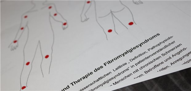 Fibromyalgie – Diagnose mit Stolpersteinen Diagnose Fibromyalgie: Eine erste Herausforderung ist die angemessene Differenzialdiagnostik.