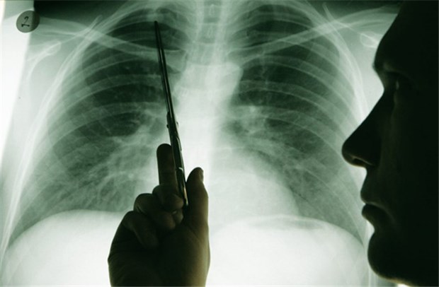 Hilfreiche Kooperation mit Studienbüro Diagnose Lungenkrebs: Für Patienten, Praxen und Kliniken kann die Beteiligung an einer klinischen Studie hilfreich sein.
