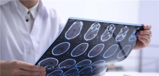 Diagnose MS: Kommen noch Komorbiditäten wie zum Beispiel Hypertonie, Hyperlipidämie und psychiatrische Störungen hinzu, kann das die Krankheitsaktivität erhöhen.