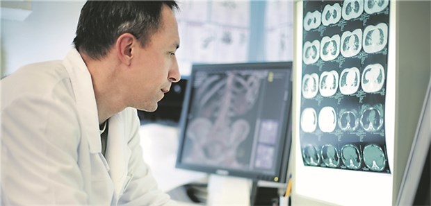 Erste europäische Leitlinie zu Bronchiektasen Diagnose von Bronchiektasen: Validierte CT-Scores gibt es noch nicht.